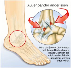 Geprellt fuß Ellenbogen geprellt